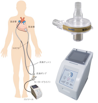 体外設置型VAD バイオフロート